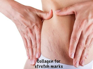 Collagen and Stretch Marks: Supporting Skin Elasticity Naturally